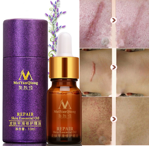 Scar Skin Repair Essential Oil | Lavender 10 ML - Frazeshop