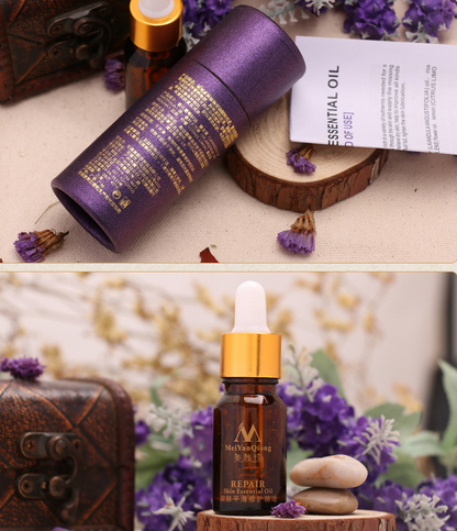 Scar Skin Repair Essential Oil | Lavender 10 ML - Frazeshop